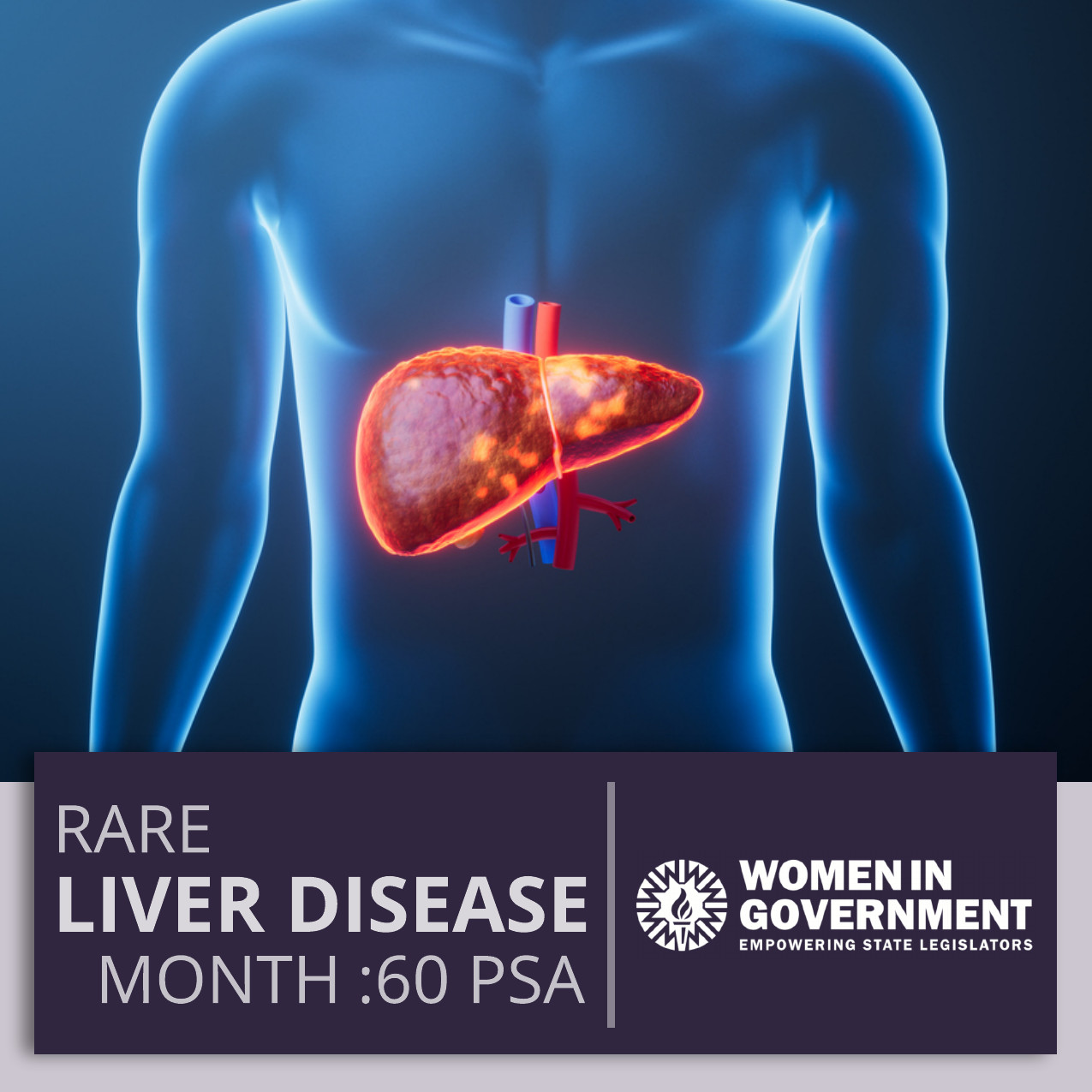 RARE LIVER DISEASE MONTH ARTWORK